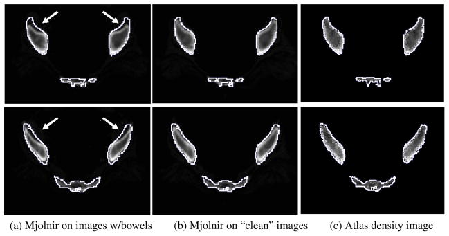 Fig. 14