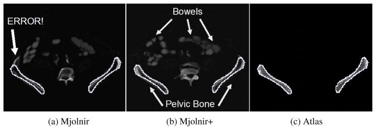 Fig. 13