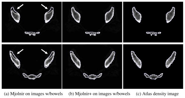 Fig. 15