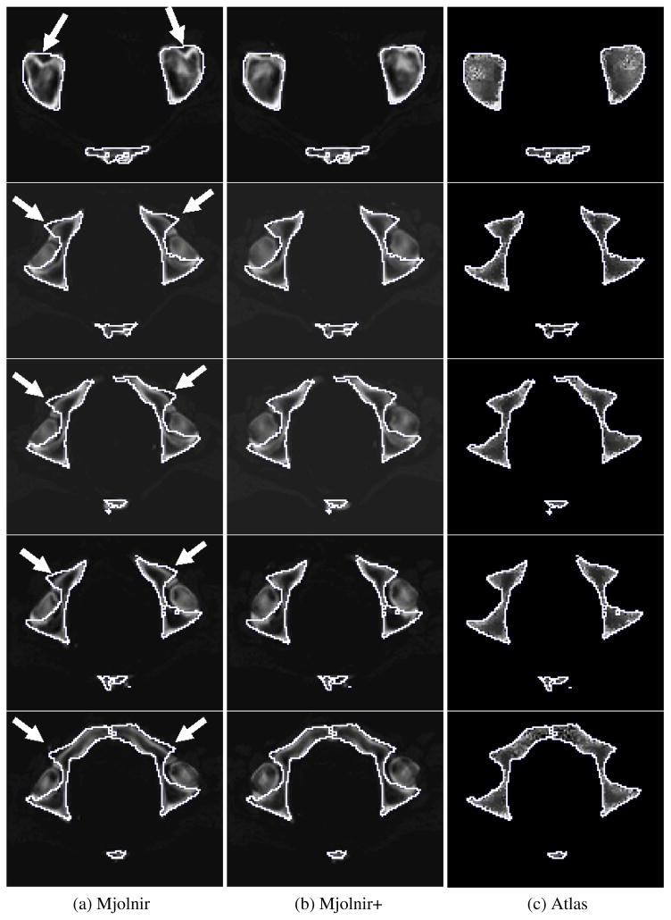 Fig. 12