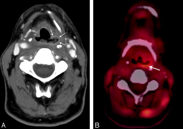 Fig 4.