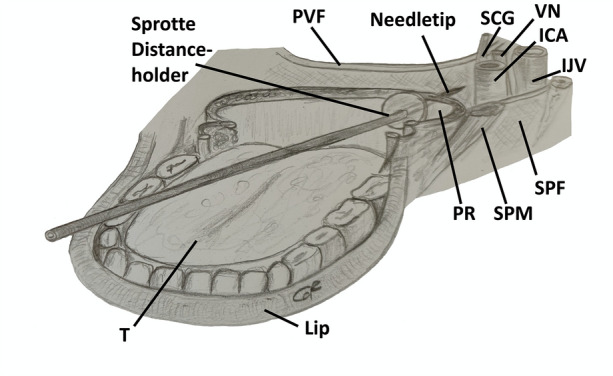 Fig. 2