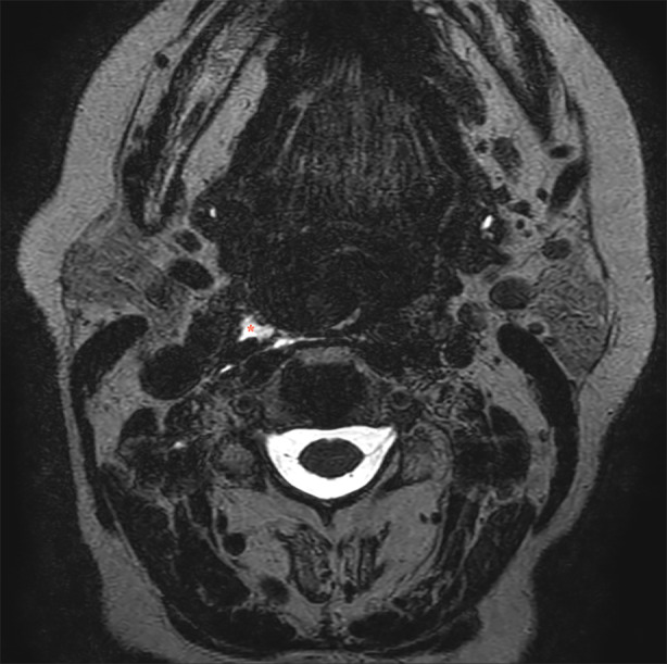 Fig. 3