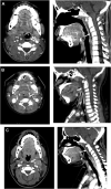 Fig. 3