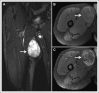 Fig 3.