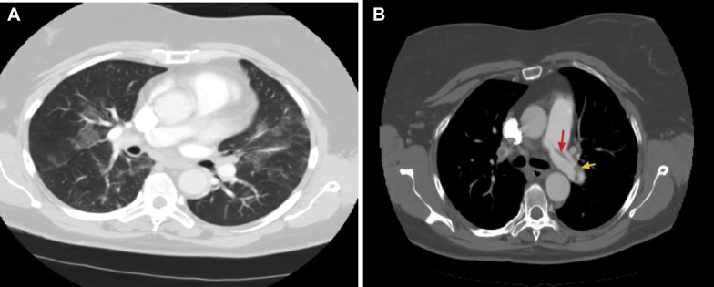 Figure 2