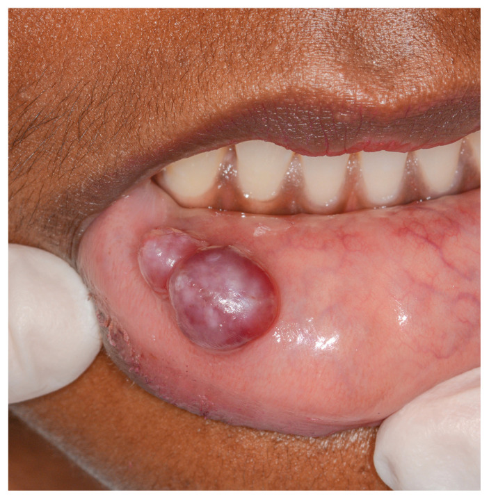 Figure 1:
