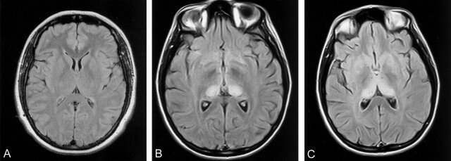 Fig 1.