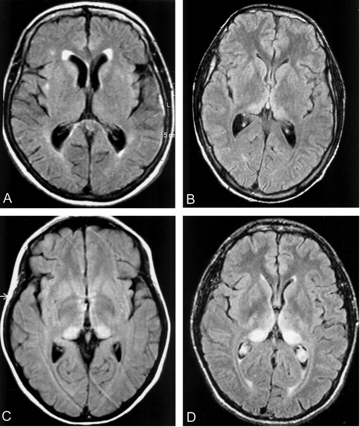 Fig 2.