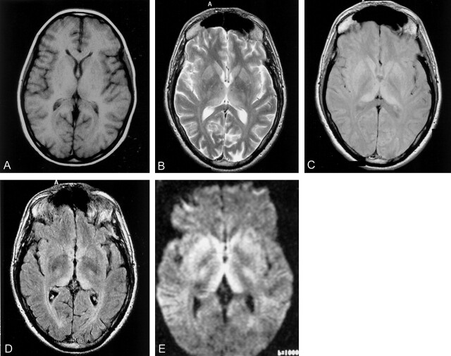 Fig 3.