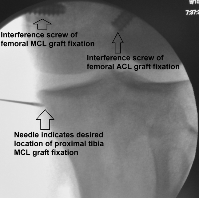 Fig 14