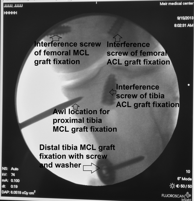 Fig 18