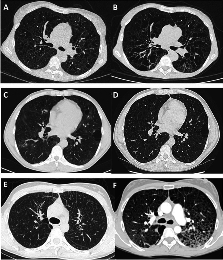 Fig. 1