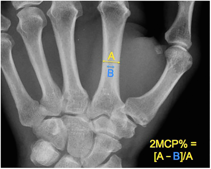 Figure 2