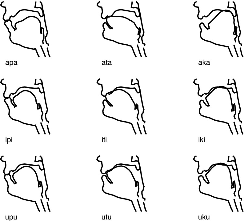 FIG. 11.