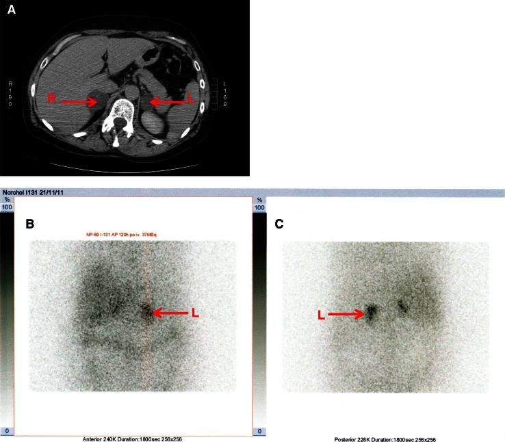 Fig. 3