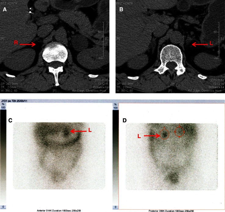 Fig. 2