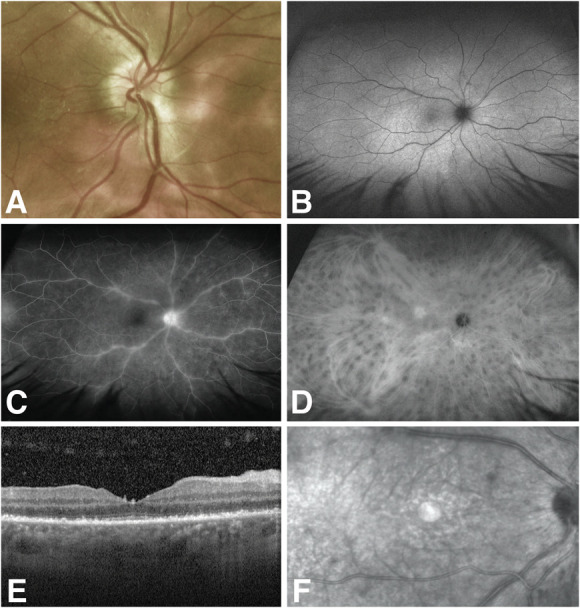 FIG. 2.