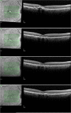 Fig. 3