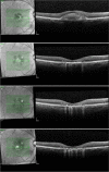 Fig. 4