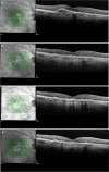 Fig. 5