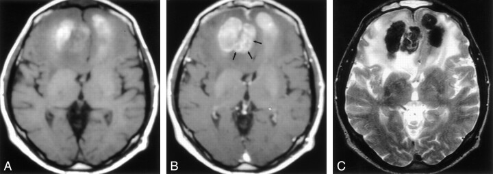 Fig 1.
