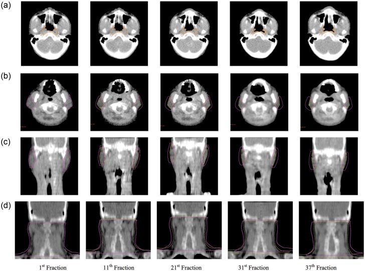 Fig. 9.