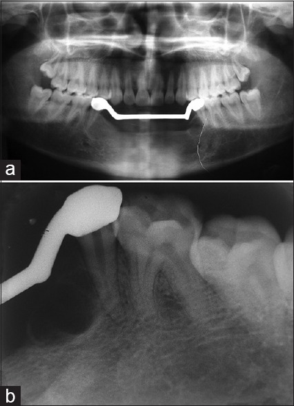 Figure 14