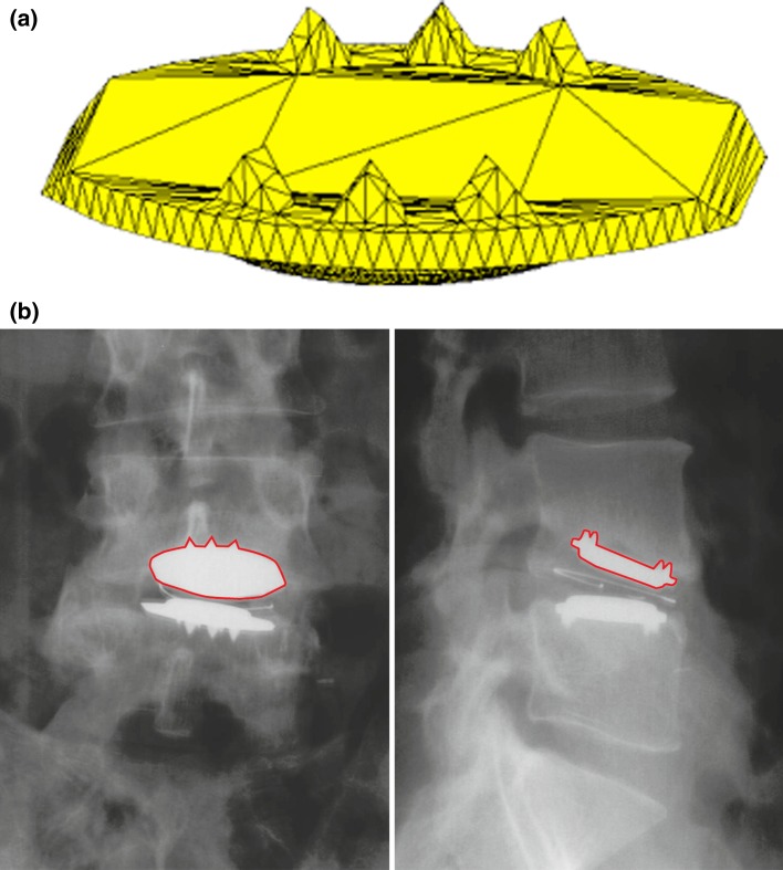 Fig. 1