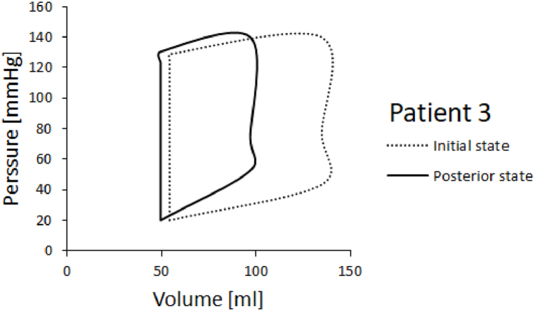 Fig. 14