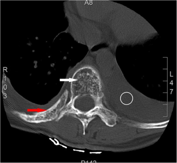 Fig. 11