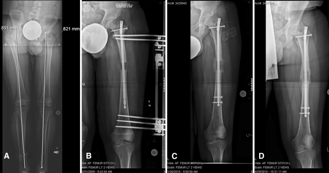 Fig. 1A–D