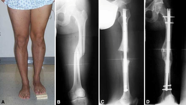 Fig. 2A–D