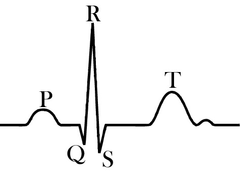 Fig. 14