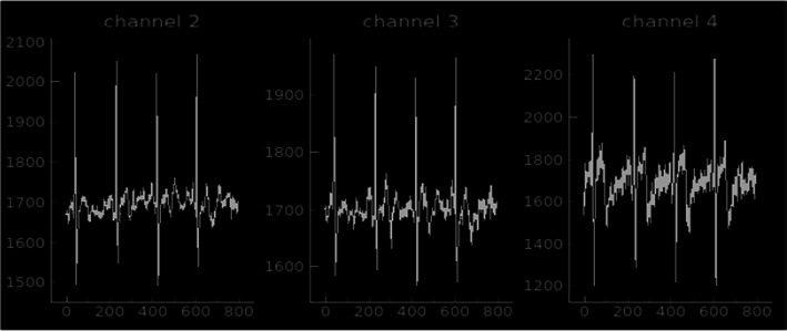 Fig. 13