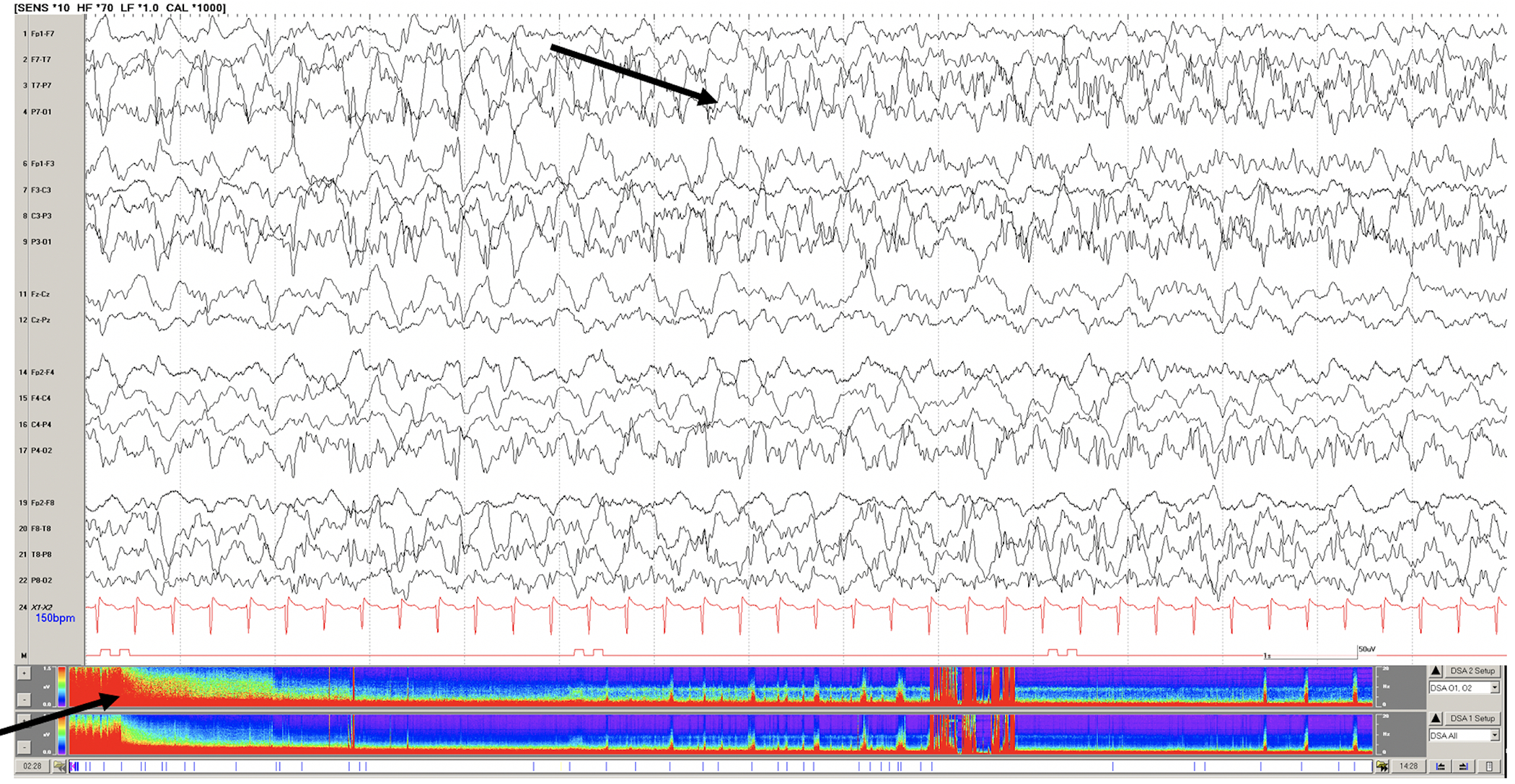 Figure 1: