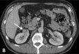 Fig 1B