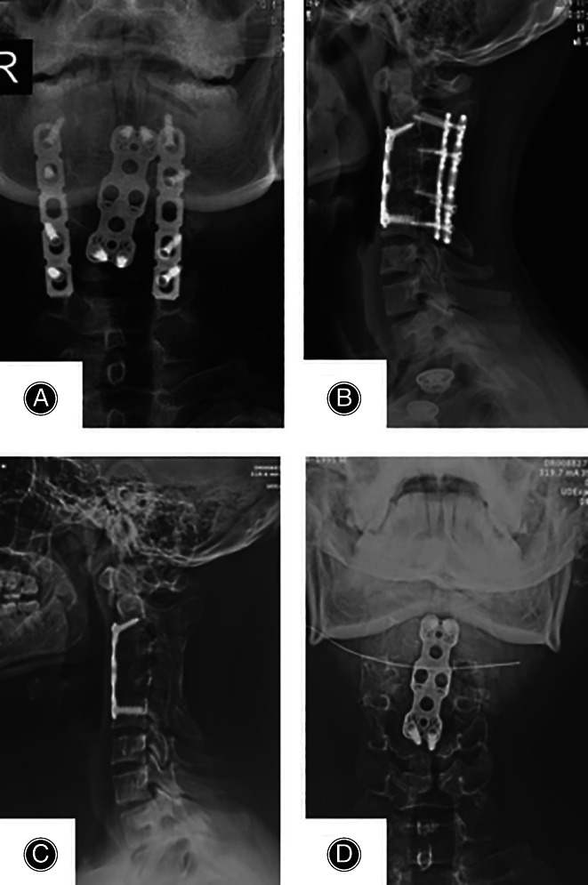 Fig. 3