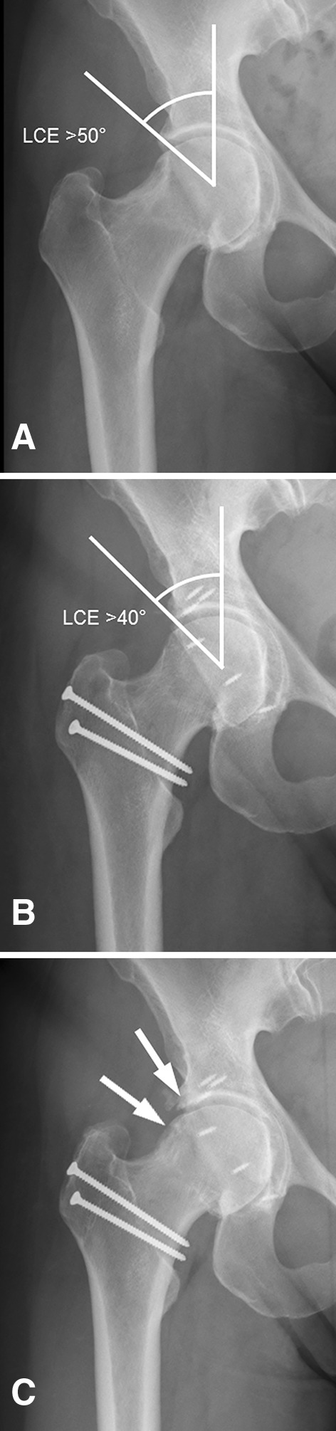 Fig. 4A–C