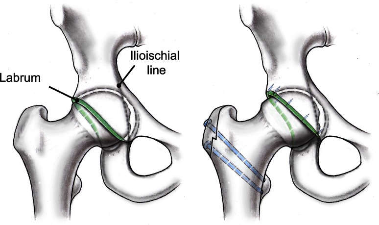 Fig. 1