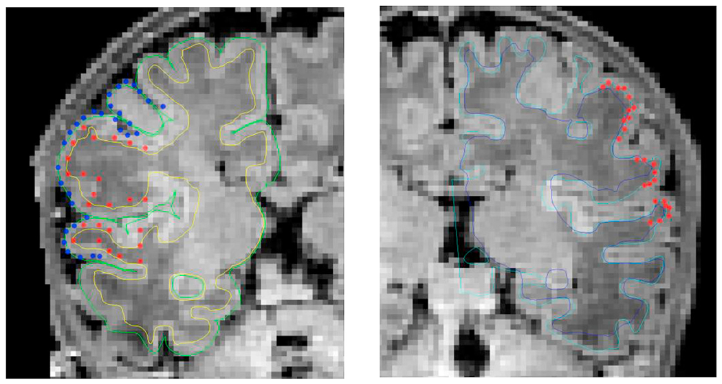 Fig. 23.