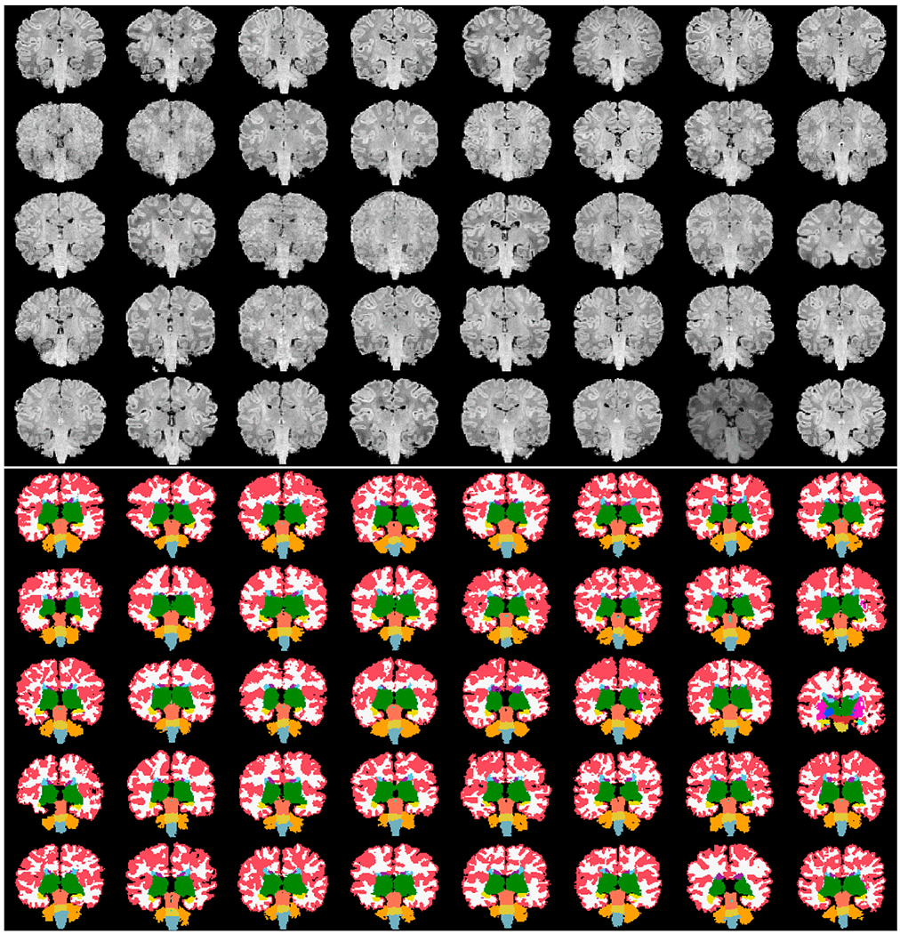 Fig. 17.