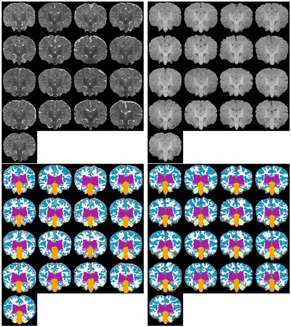 Fig. 12.