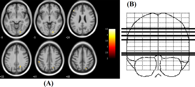 Figure 1: