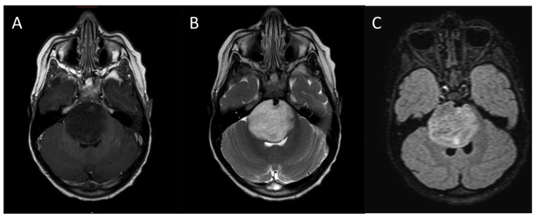 FIGURE 2