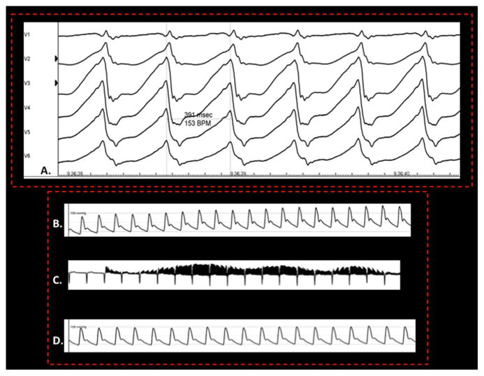 Fig. 4