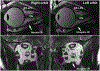 FIG 6.
