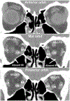 FIG 4.