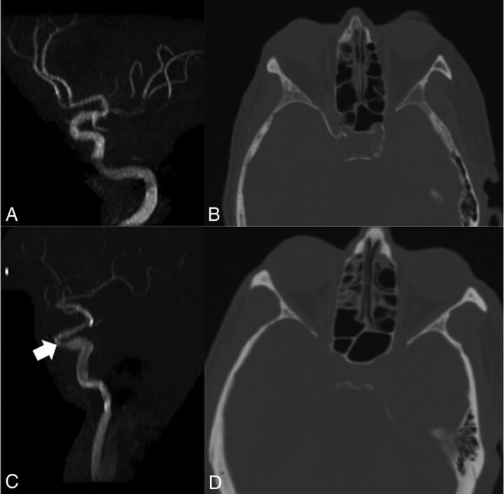 Fig 3.