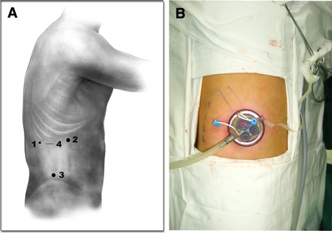 Fig. 1